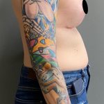 Breast Augmentation + Lift Before & After Patient #1434